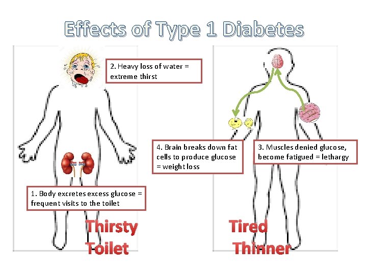 Effects of Type 1 Diabetes 2. Heavy loss of water = extreme thirst 4.