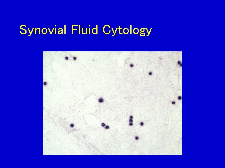 Synovial Fluid Cytology 