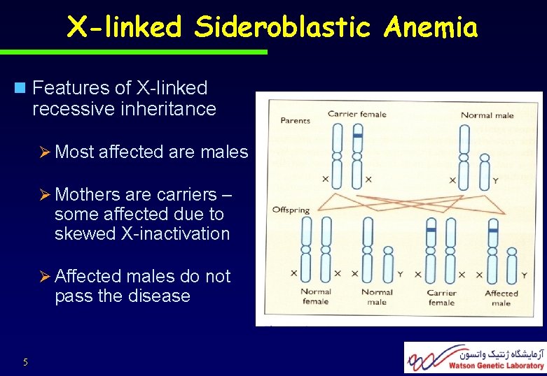 X-linked Sideroblastic Anemia n Features of X-linked recessive inheritance Ø Most affected are males
