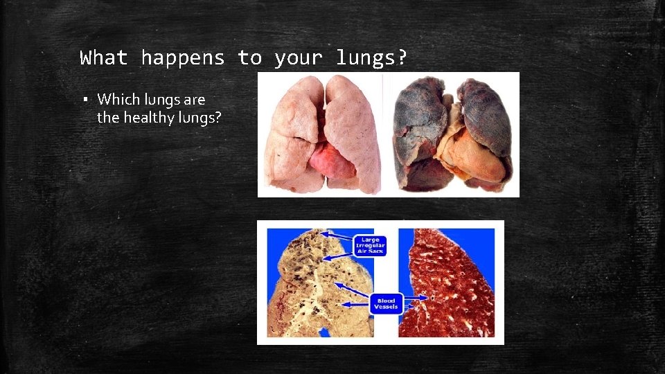 What happens to your lungs? ▪ Which lungs are the healthy lungs? 