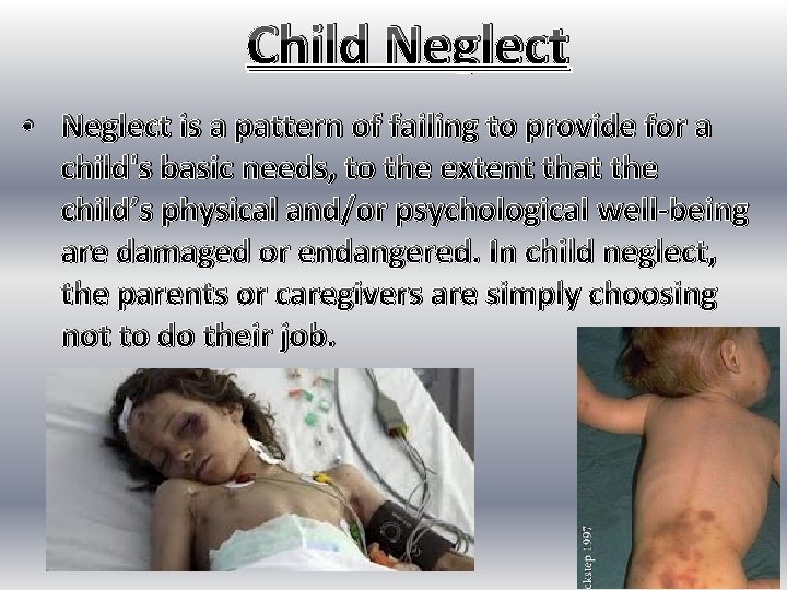 Child Neglect • Neglect is a pattern of failing to provide for a child's