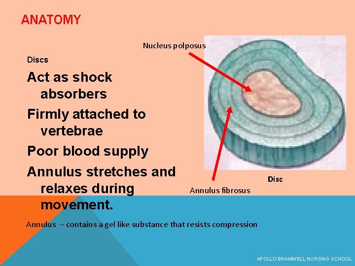 ANATOMY Nucleus polposus Discs Act as shock absorbers Firmly attached to vertebrae Poor blood