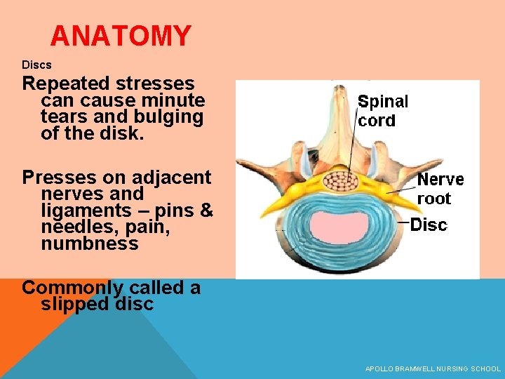 ANATOMY Discs Repeated stresses can cause minute tears and bulging of the disk. Presses