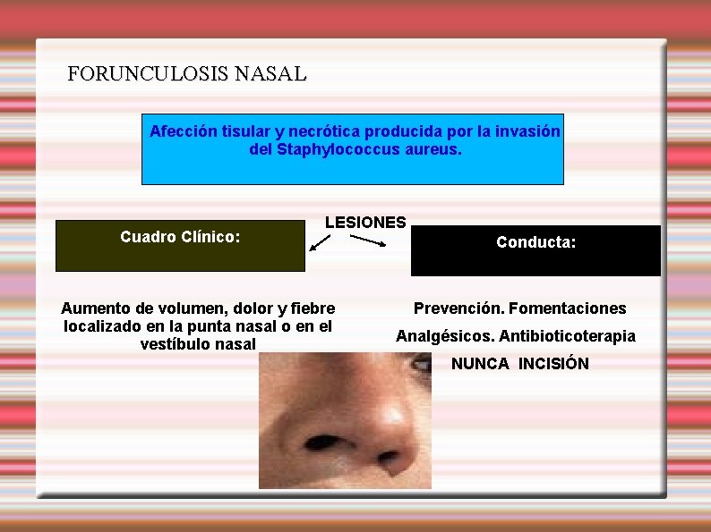 FORUNCULOSIS NASAL Afección tisular y necrótica producida por la invasión del Staphylococcus aureus. Cuadro