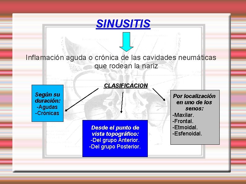 SINUSITIS Inflamación aguda o crónica de las cavidades neumáticas que rodean la nariz CLASIFICACION