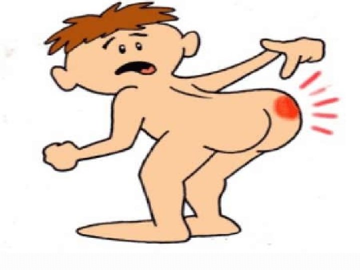 Stages / Classification Of Bedsores 