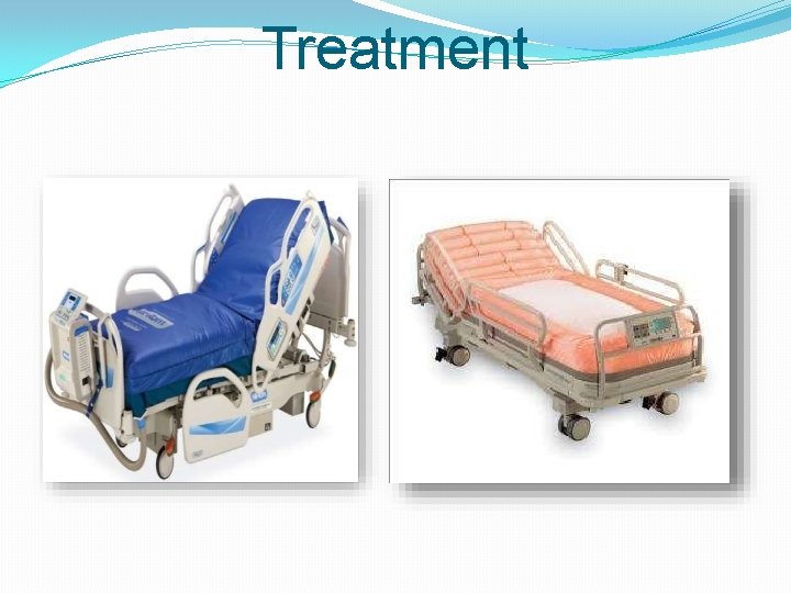 Treatment 
