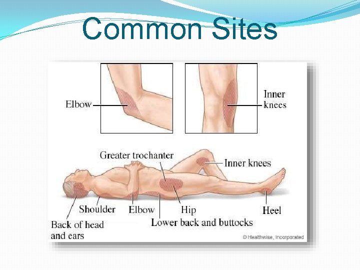 Common Sites 