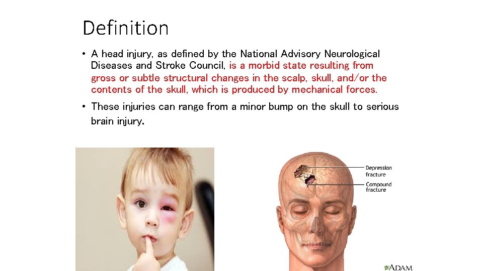 Definition • A head injury, as defined by the National Advisory Neurological Diseases and