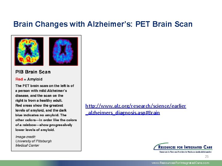 Brain Changes with Alzheimer’s: PET Brain Scan http: //www. alz. org/research/science/earlier _alzheimers_diagnosis. asp#Brain 25