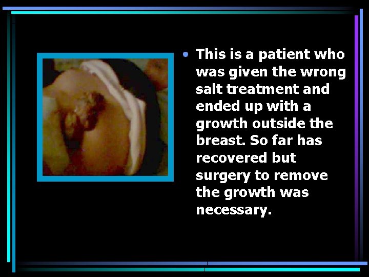  • This is a patient who was given the wrong salt treatment and