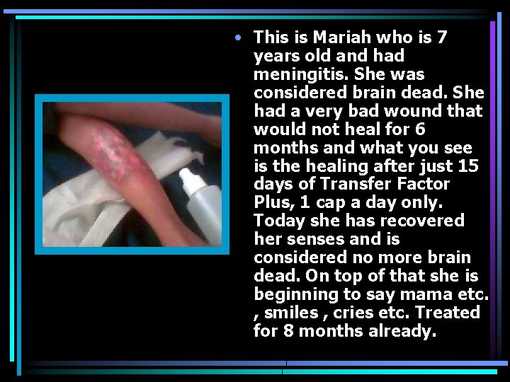  • This is Mariah who is 7 years old and had meningitis. She
