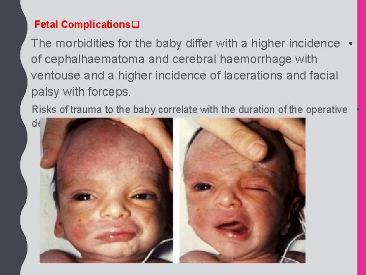 Fetal Complicationsq The morbidities for the baby differ with a higher incidence • of