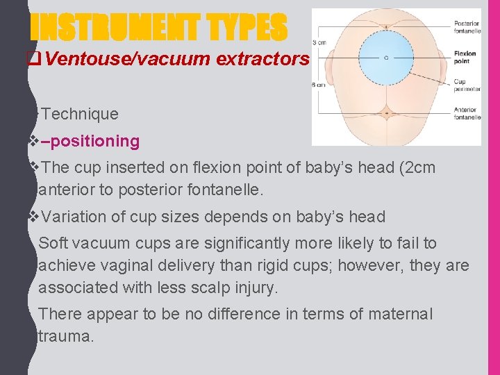INSTRUMENT TYPES q. Ventouse/vacuum extractors v. Technique v–positioning v. The cup inserted on flexion