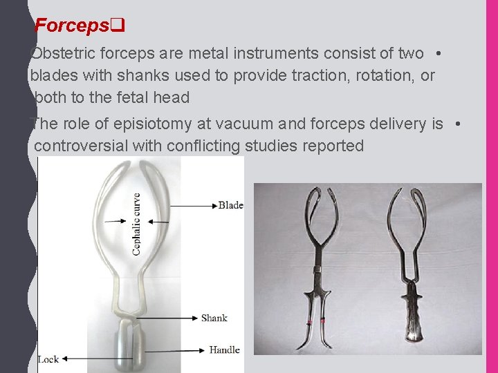 Forcepsq Obstetric forceps are metal instruments consist of two • blades with shanks used