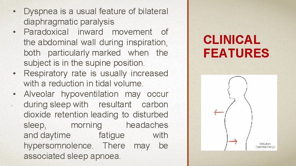  • Dyspnea is a usual feature of bilateral diaphragmatic paralysis • Paradoxical inward