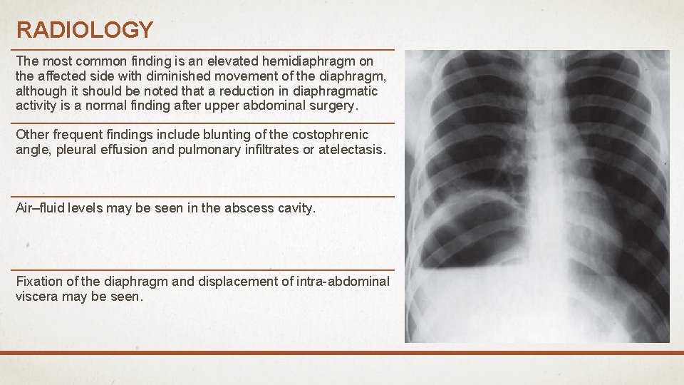 RADIOLOGY The most common finding is an elevated hemidiaphragm on the affected side with
