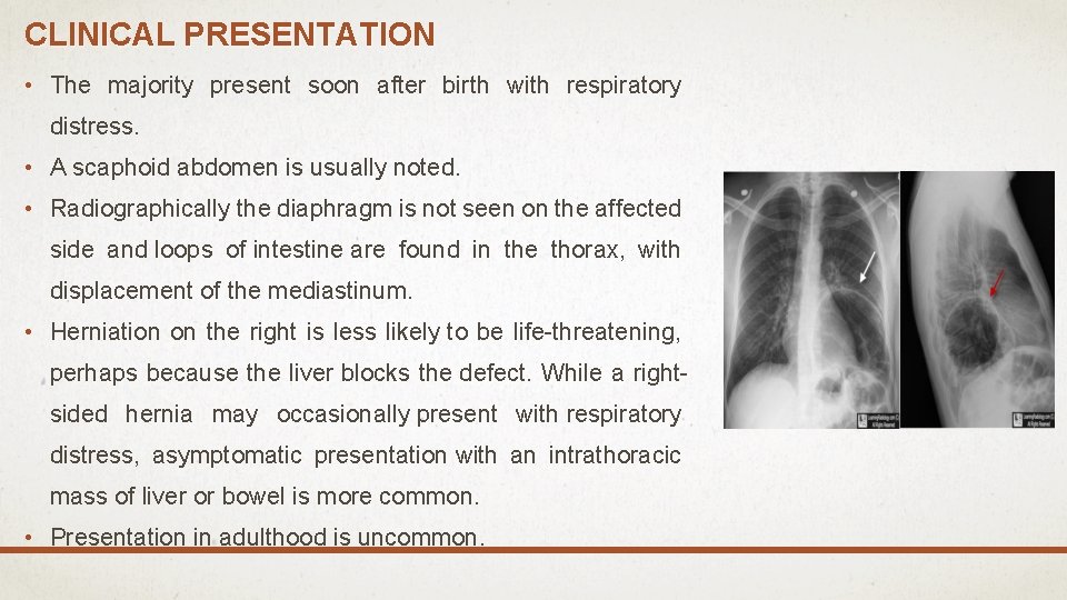CLINICAL PRESENTATION • The majority present soon after birth with respiratory distress. • A