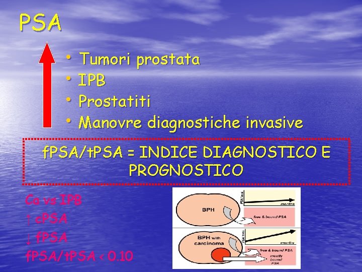 PSA • Tumori prostata • IPB • Prostatiti • Manovre diagnostiche invasive f. PSA/t.