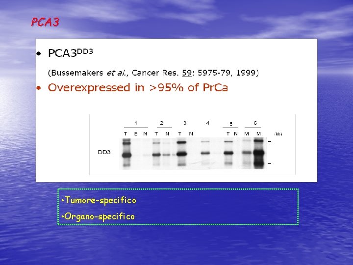 PCA 3 • Tumore-specifico • Organo-specifico 