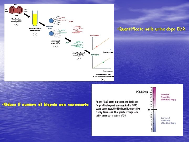  • Quantificato nelle urine dopo EDR • Riduce il numero di biopsie non