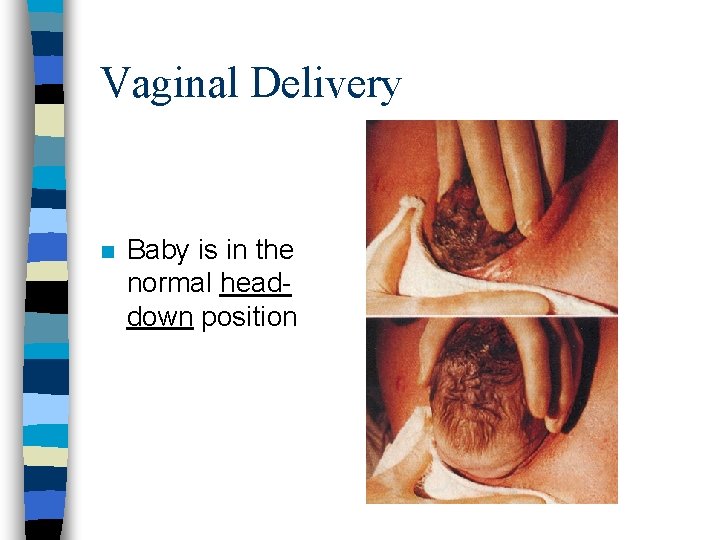 Vaginal Delivery n Baby is in the normal headdown position 