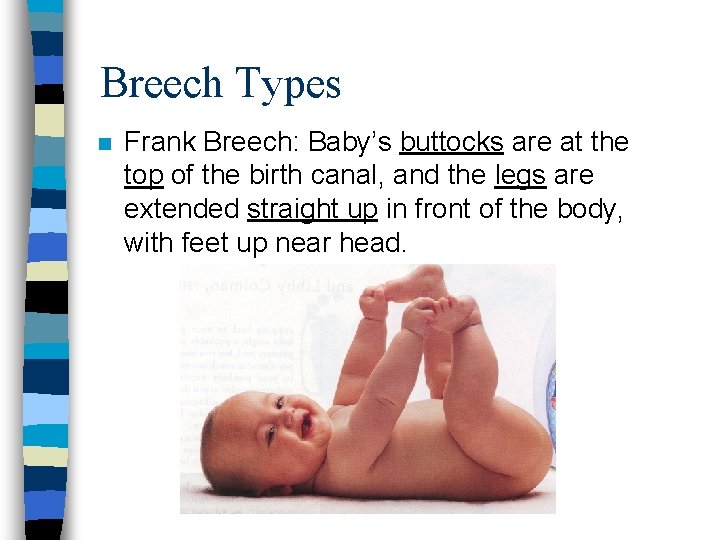 Breech Types n Frank Breech: Baby’s buttocks are at the top of the birth