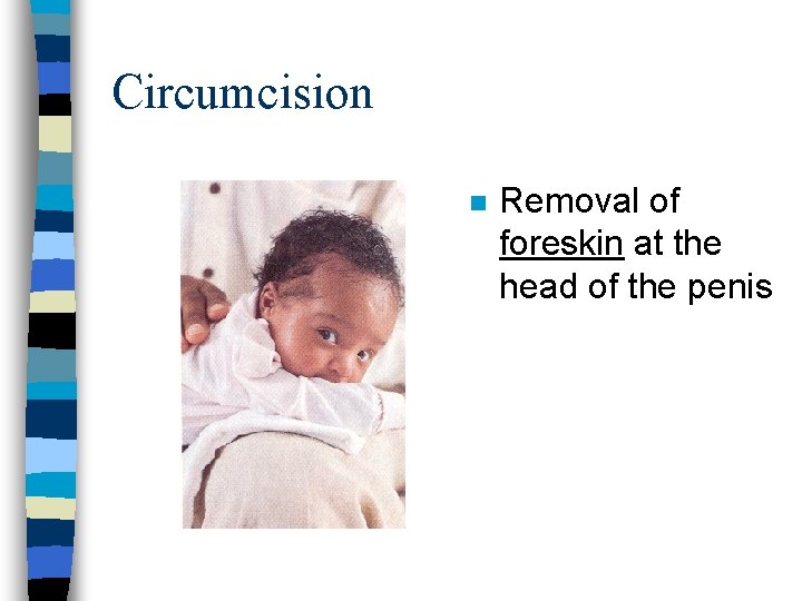 Circumcision n Removal of foreskin at the head of the penis 