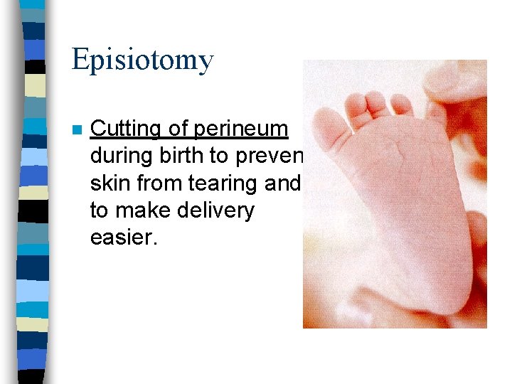 Episiotomy n Cutting of perineum during birth to prevent skin from tearing and to