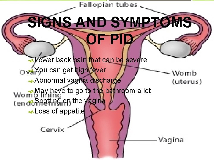 SIGNS AND SYMPTOMS OF PID Lower back pain that can be severe You can