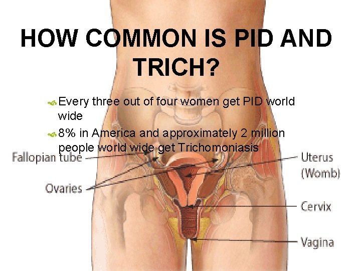 HOW COMMON IS PID AND TRICH? Every three out of four women get PID