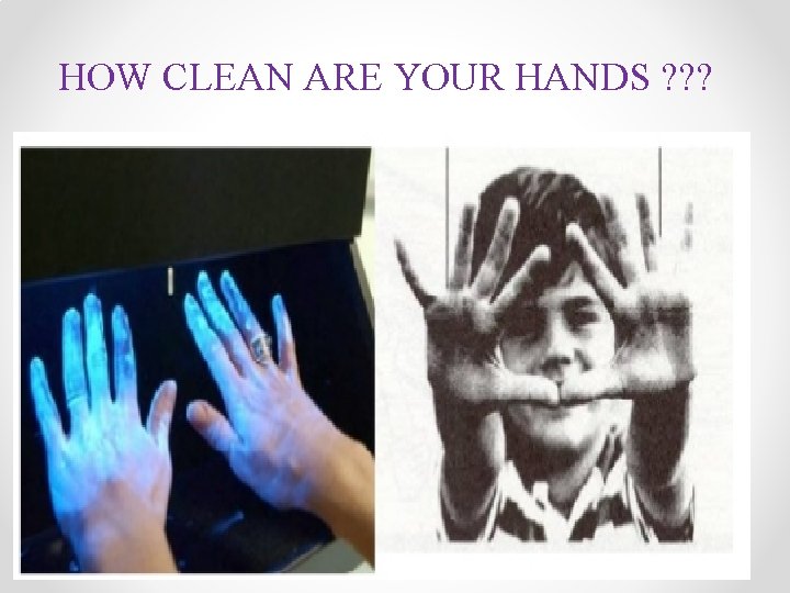 HOW CLEAN ARE YOUR HANDS ? ? ? 