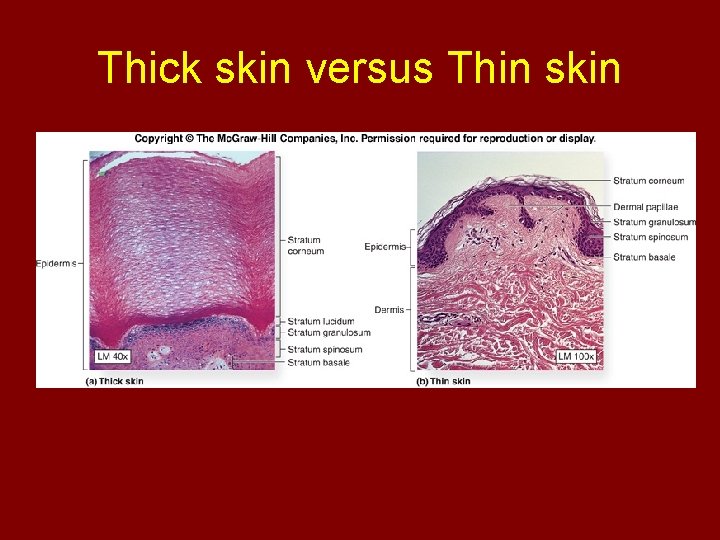 Thick skin versus Thin skin 