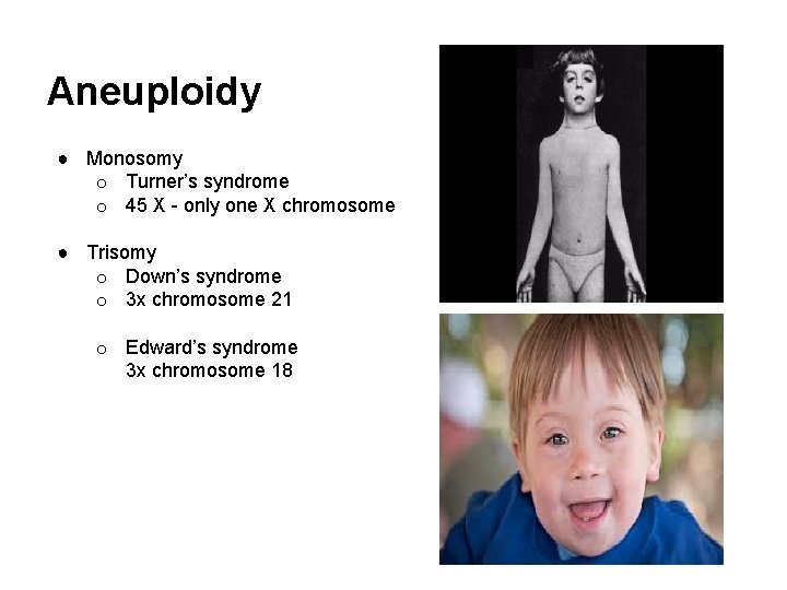 Aneuploidy ● Monosomy o Turner’s syndrome o 45 X - only one X chromosome