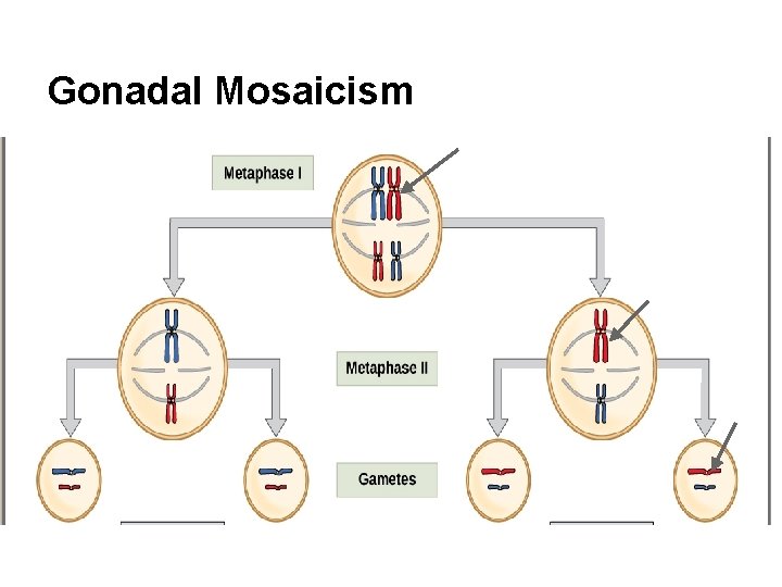 Gonadal Mosaicism 