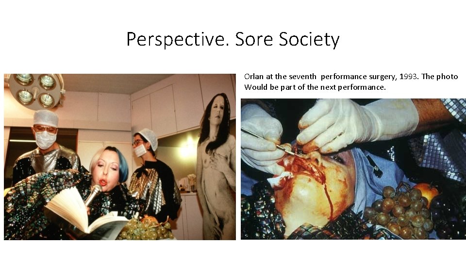 Perspective. Sore Society Orlan at the seventh performance surgery, 1993. The photo Would be