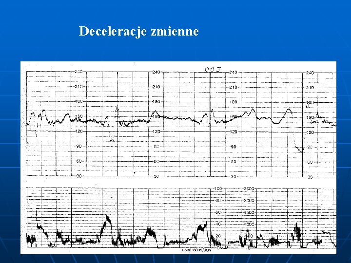 Deceleracje zmienne 