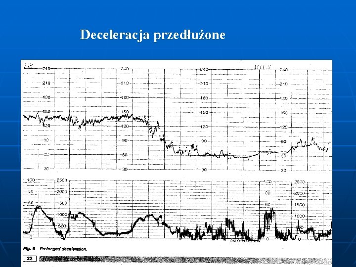 Deceleracja przedłużone 