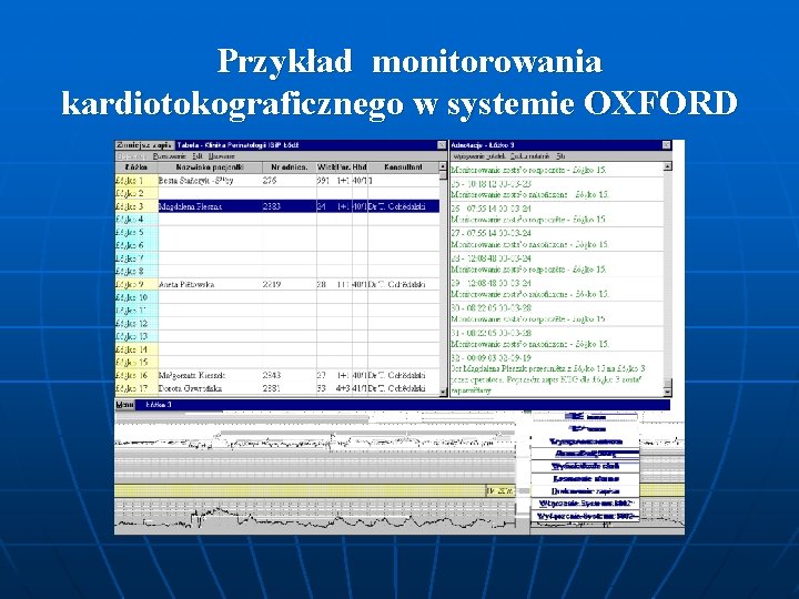 Przykład monitorowania kardiotokograficznego w systemie OXFORD 