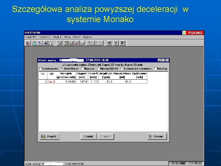 Szczegółowa analiza powyższej deceleracji w systemie Monako 