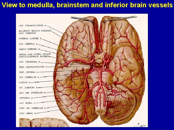 View to medulla, brainstem and inferior brain vessels 