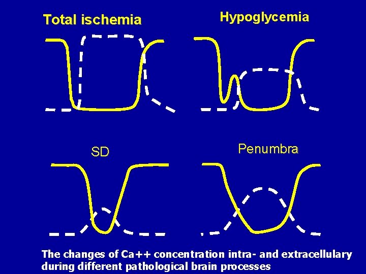 Úplná ischémia Total ischemia SD Hypoglycemia Penumbra The changes of Ca++ concentration intra- and