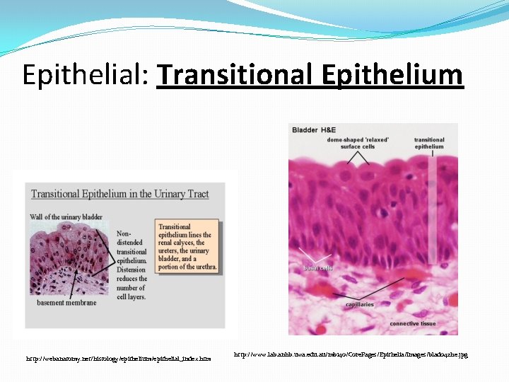Epithelial: Transitional Epithelium http: //webanatomy. net/histology/epithelium/epithelial_index. htm http: //www. lab. anhb. uwa. edu. au/mb