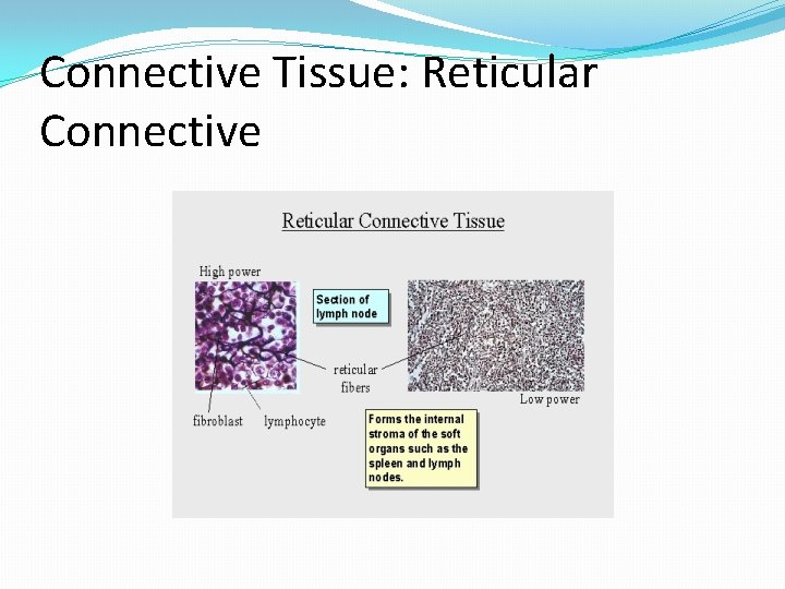 Connective Tissue: Reticular Connective 