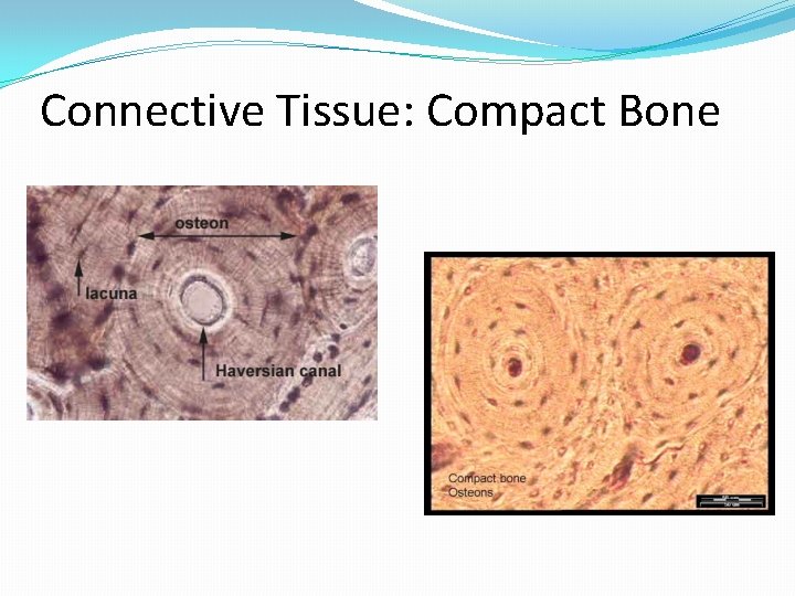 Connective Tissue: Compact Bone 