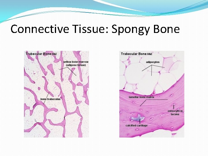 Connective Tissue: Spongy Bone 