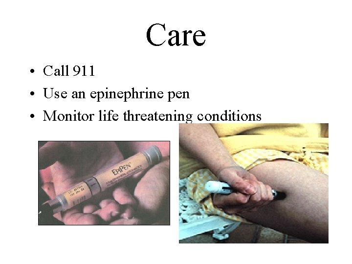 Care • Call 911 • Use an epinephrine pen • Monitor life threatening conditions