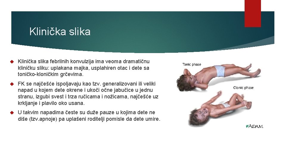 Klinička slika febrilnih konvulzija ima veoma dramatičnu kliničku sliku: uplakana majka, usplahiren otac i