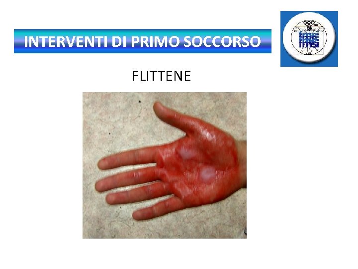 INTERVENTI DI PRIMO SOCCORSO FLITTENE 