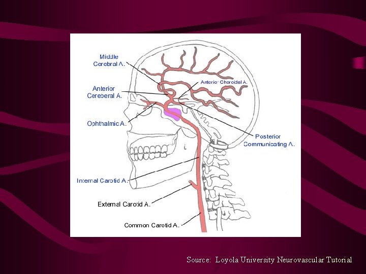 Source: Loyola University Neurovascular Tutorial 
